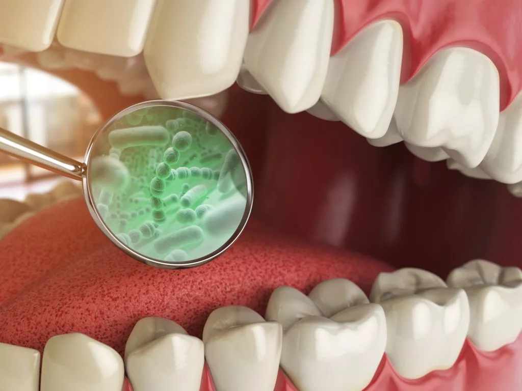Detailed 3D illustration of teeth being examined with a dental mirror that magnifies bacteria, symbolizing the diagnosis of halitosis or gum disease, set against a red gum background.
