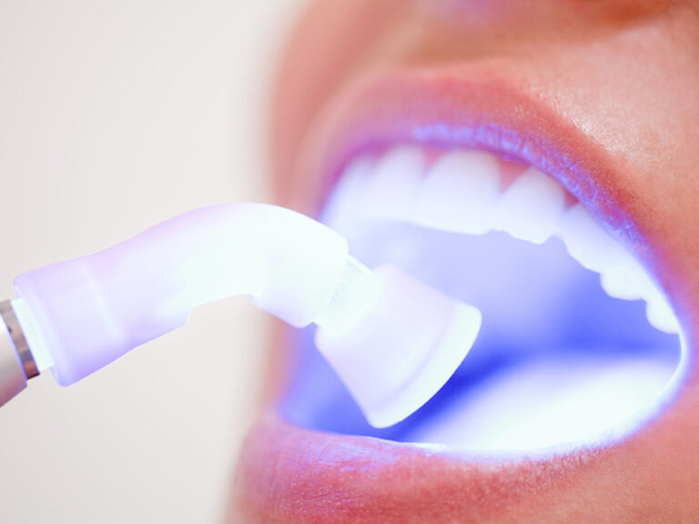 a dentist using a soft tissue laser