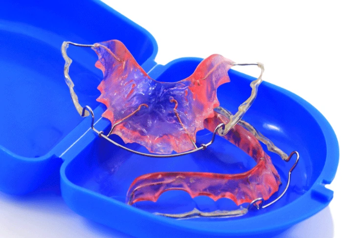 Retainers in Greenville, WI at Westhill Dental.